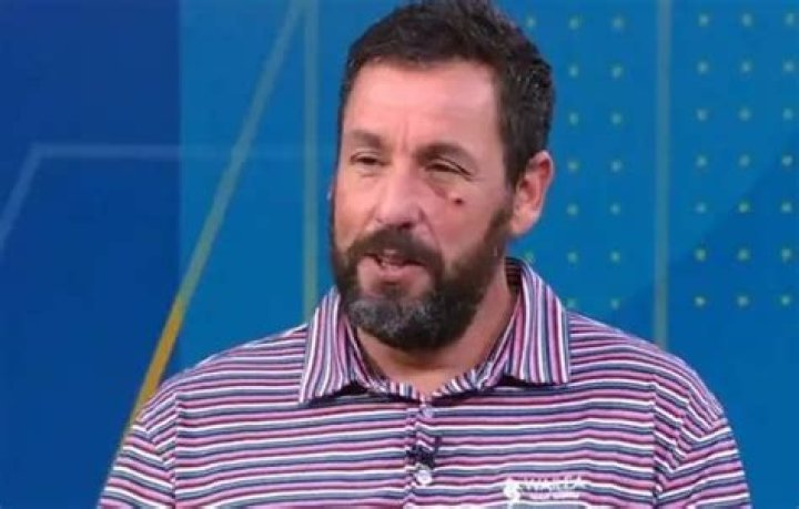 
Adam Sandler Face Injury: What Happened To His Eye? Phone Accident Explained 