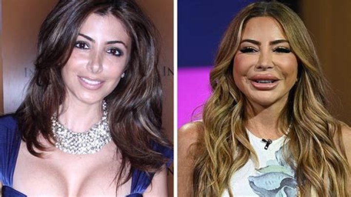 Larsa Pippen Before And After Looks: The Real Housewives Star Seems To Have Gotten A Cosmetic Surgery