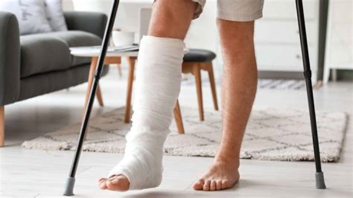 
My Father Got One Of His Legs Broken & Fixed A Rod Into It – Phyna Tells Her Story 
