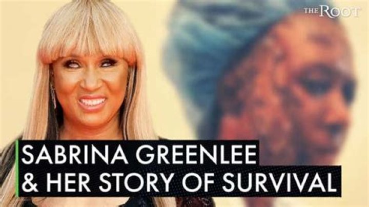 Sabrina Greenlee | Acid Attack Before and After